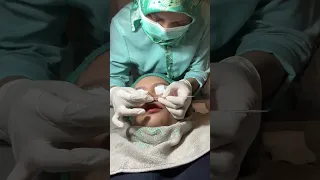 DIREY PANEN SINGKONG KOMEDO