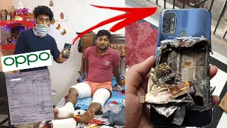 OPPO Phone Blast in Pocket near my Home | Technical dost @oppomobileindia #oppoblast