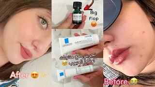 كيفاش تهنيت من الحبوب ، روتيني للعناية بالبشرة للحصول على بشرة صحية 😍✨♥️