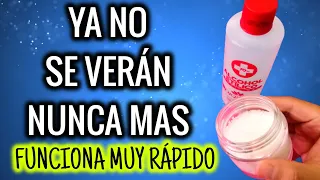 SEPÁRALOS CON SAL Y ALCOHOL YA NO SE VERÁN MAS! FUNCIONA MUY RÁPIDO
