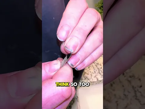 What’s Really Under Your Fingernails? 🔬😱