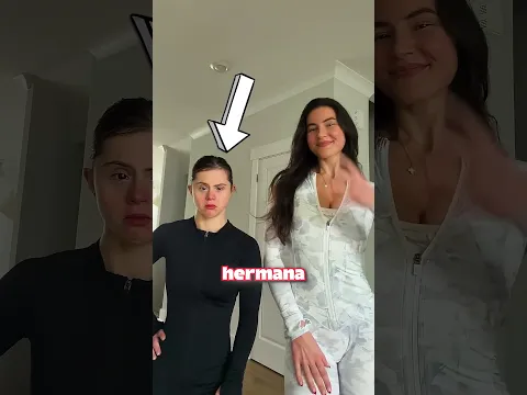 Esta Chica Cambió Su Rostro Así Para Hacerla Sonreír 😳❤️