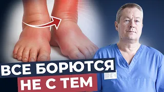 Отеки: простой метод с содой, который работает!