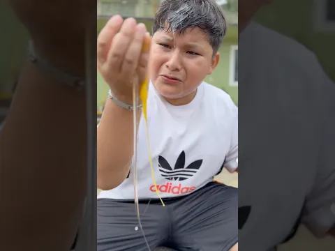 Eso le pasa por goloso