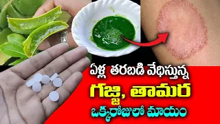 ఒక్క రోజులో తామర మటుమాయం || How to Remove Ringworm Naturally @KSKHome