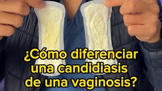 Diferencias entre candidiasis y vaginosis | Dr. William Guerrero