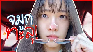 เมื่อจมูกจะทะลุกะทันหัน เลยต้องไปผ่าตัดด่วน!😭😭 | mintchyy