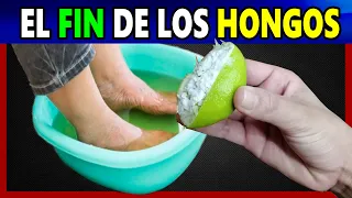 👉 Aplica esto en tus uñas y podrás Acabar Con los molestos hongos