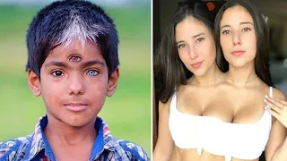 జీవితంలో ఇలాంటి వీడియోలను మీరు అస్సలు చూసి ఉండరు.! కావాలంటే మీరే చూడండి || Strangest Human