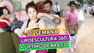 DIARIO - 2 ✨ SEGUNDA SEMANA PÓS LIPOESCULTURA 360° + LIFTING DE BRAÇO 🎊
