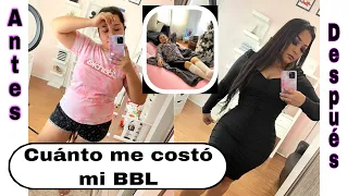 BBL Experiencia | Cuanto cuesta un BBL | Donde y Con Quien me operé | Resultados con Tres semanas