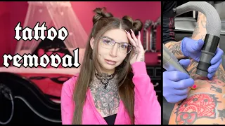 i got laser tattoo removal & didn't expect this..