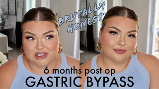 6 MONTHS POST OP GASTRIC BYPASS UPDATE