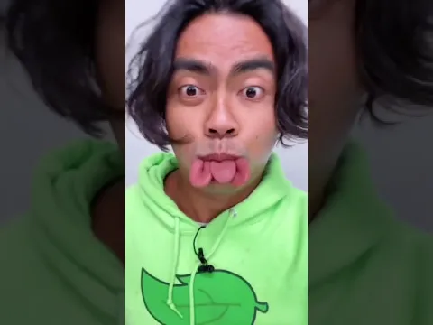 WHEN YOU BITE YOUR TONGUE  🤯😭