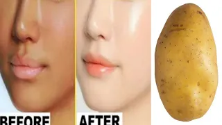 सिर्फ 1आलू से पाए 10 गुना ज्यादा ग्लो | Skin whitening at home remedies/Anti Aging,fair skin,fair