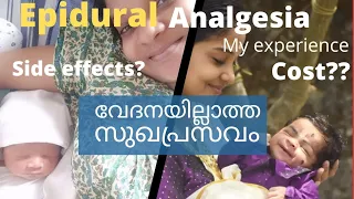 Painless delivery story malayalam | Epidural | വേദനയില്ലാതെ സുഖപ്രസവം | My experience #epidural