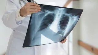 Descubrimientos médicos que cambiaron la historia.