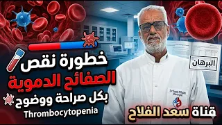 خطورة نقص الصفائح الدموية بكل صراحة ووضوح thrombocytopenia | الأسباب والعلاج