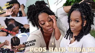PCOS Journey! Hair Loss & Thinning | Illusion Crochet on THIN Hair | Janet Collection Butterfly Locs