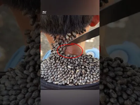 अगर शरीर पर टिक चिपक जाए तो उसे कैसे उतारना चाहिए 😳 #shorts #ytshorts