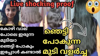 മാസങ്ങൾക്കുള്ളിൽ Shocking Hair Growth||നിങ്ങൾക്കും ഈസി ആയി മുടി വളർത്താം||#hair #growth