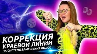 Фиксация краевой линии парика, системы замещения волос.
