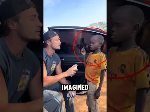 He didn’t realize larvae were growing inside him‼️😱