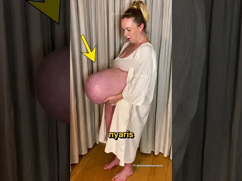 Melahirkan Bayi Kembar Tiga