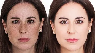 MANCHAS: ¿Cómo eliminar las manchas faciales? | Miriam Llantada