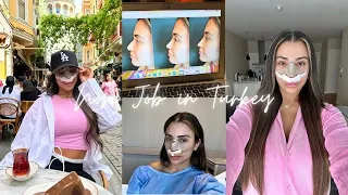My Rhinoplasty Experience in Istanbul Turkey with Dr.Resit Burak Kayan