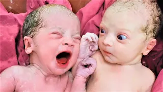 A Rare Triplet Arrival | Two Shown, One With Growth Restriction (IUGR)