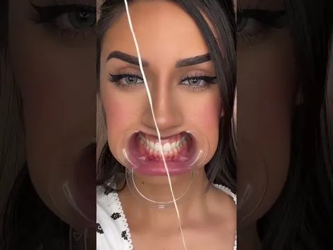Teeth ASMR 🦷 💦
