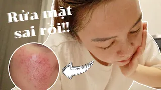 5 Sai Lầm Khi Rửa Mặt Mà Nhiều Người Mắc Phải 😱 Common Mistakes In Cleansing ❤️ TrinhPham