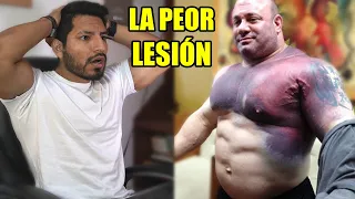 LA PEOR LESIÓN EN EL GIMNASIO - Hombre se Rompe el Pectoral Entrenando