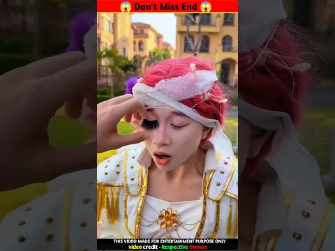 तुम्हें चोट लग गईकि आप इनकी 😐🥹