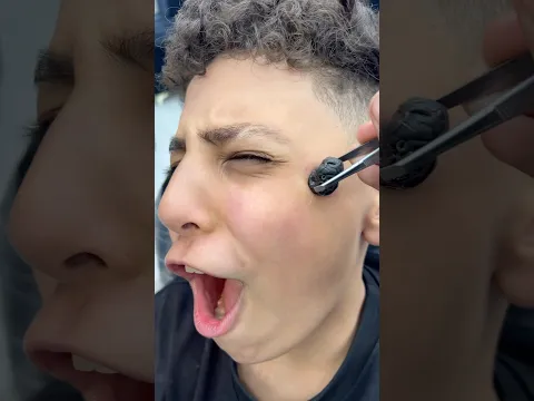 ازالة الحباية المتسلطنة من الخد✂️🥵 #fyp #foryou #foryoupage #viral #explore #comedy #asmr