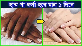 আঙ্গুল ফর্সা: আঙ্গুলের ভাঁজের কালো দাগ দূর হাত-পা ফর্সা করার পদ্ধতি/ আঙুল ফর্সা করার উপায়