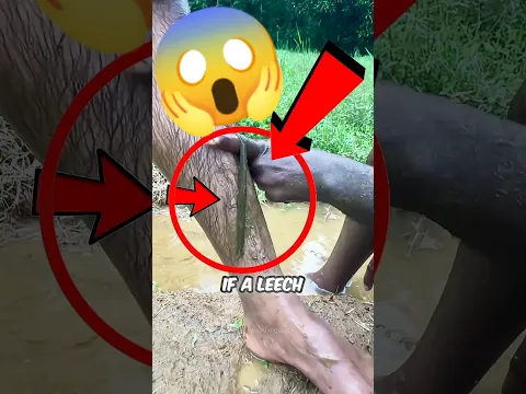Nunca intentes quitar una sanguijuela de esta manera! 😱