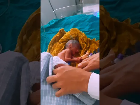 Premature 🤔😰😰 #junior #babybirth #adorable #premature #chubby #cute #baby #shorts