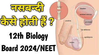 Nasbandi Kaise Hoti Hai ? Nasbandi | Vasectomy | Sterilization | 12th Biology Board 2024 And NEET