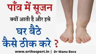 Ankle and Leg Swelling | घर बैठे पाइए एडी में सूजन, पाँव में सूजन का सटीक इलाज Complete Info Hindi
