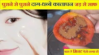 टमाटर को 5 मिनट ऐसे लगा ले चेहरे के पुराने से पुराने काले दाग-धब्बे, पिग्मेन्टेशन झाइयां जड़ से खत्म