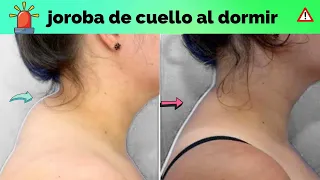 cómo quitar la JOROBA DE CUELLO MIENTRAS DUERMES