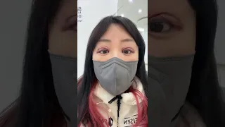 #쌍수재수술 높았던눈 낮추기