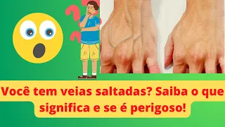Você tem as VEIAS das mãos SALTADAS? Saiba o que isso SIGNIFICA e se é perigoso!