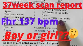 gender predict using Scan Reports in tamil/ how to find boy or girl scan report/ramsaran channel