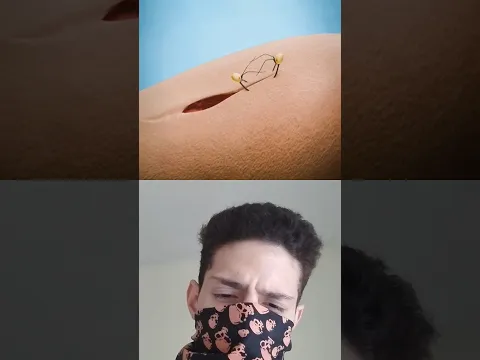 Puedes usar una hormiga como grapas de sutura? 🐜 🪖 #shorts #parati #viral #short