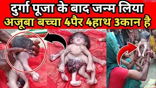 जन्म लिया अजूबा बच्चा जिसको है 4 पैर 4 हाथ 3 कान 1 मुंडी । लोग मन रहे है भगवान ।