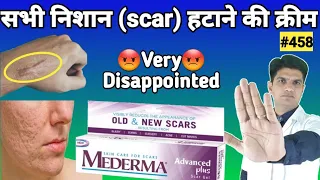 Mederma cream | mederma for acne scars | mederma advanced scar gel review