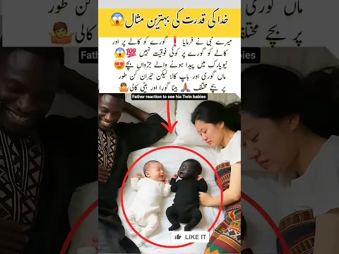 2 months different colours twin babies🍼 Surprised father😱 #trending #baby #twins #babygirl #shorts